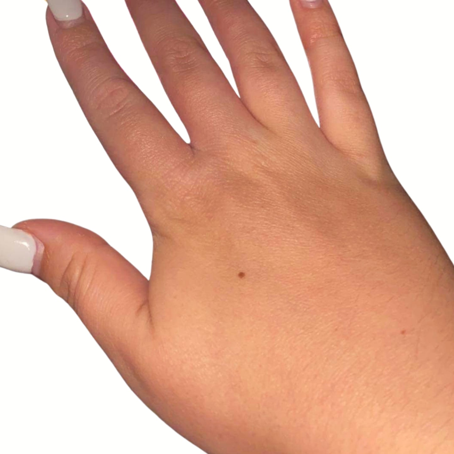 Freeskin Eczema Relief Cream: Hands After